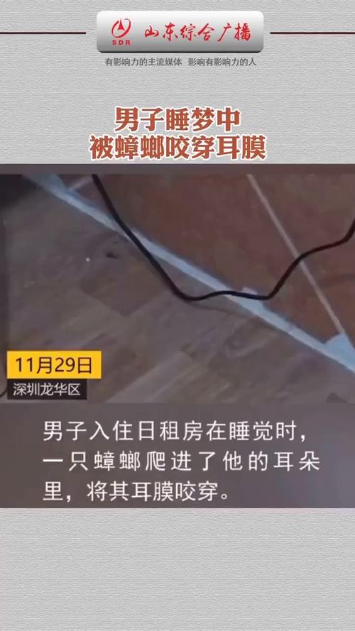 为什么成人睡觉的时候蟑螂喜欢爬在她身上男子睡梦中蟑螂呛进气管蟑螂为什么会咬煤气胶管 17款(335618)